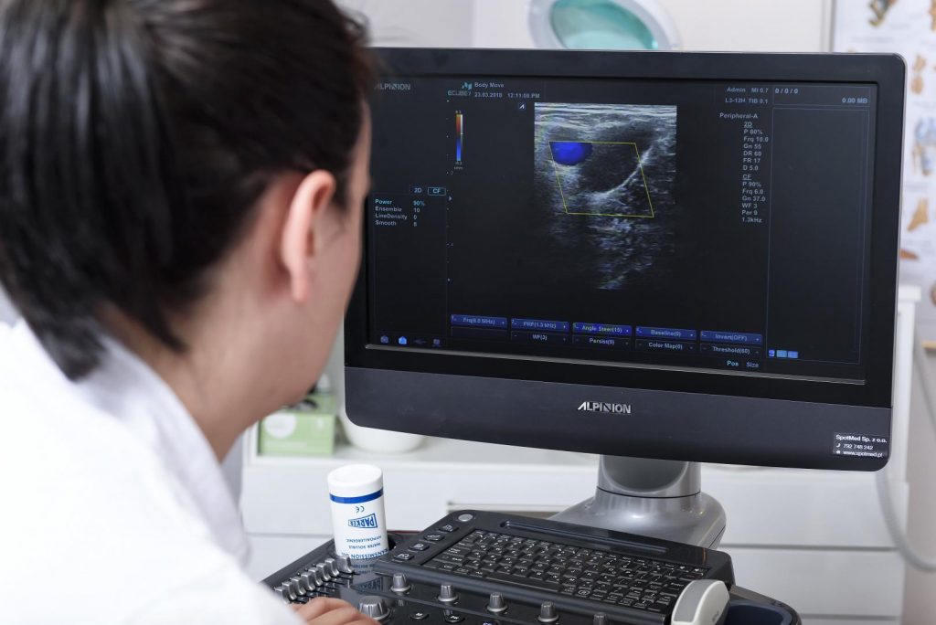 Skleroterapia – czym jest i dla kogo?