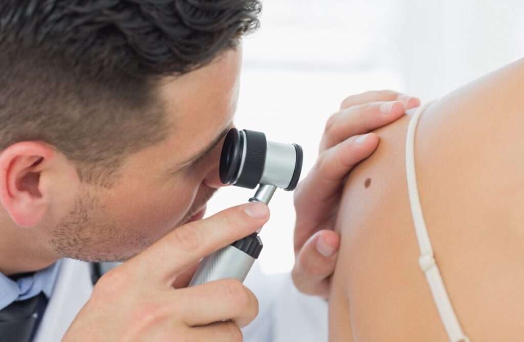 Jak działa dermatoskop?